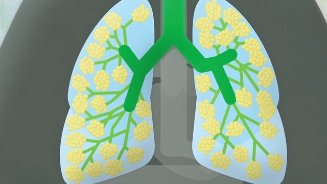 Les infections respiratoires смотреть онлайн