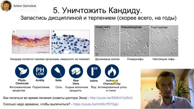 9 шагов по очищению от кандиды от Heal Your Gut Guy (8 февраля 2019) (Антон Самокат) смотреть онлайн