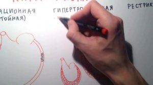 Кардиомиопатии - общая характеристика