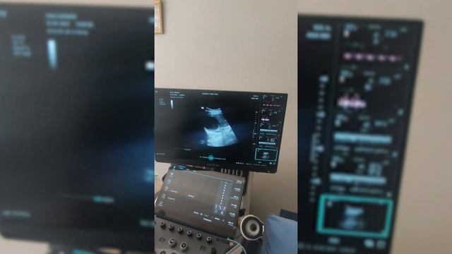 Эхинококк печени и определение оперативного доступа смотреть онлайн