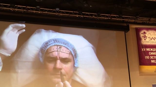 Ботокс мужчины симпозиум