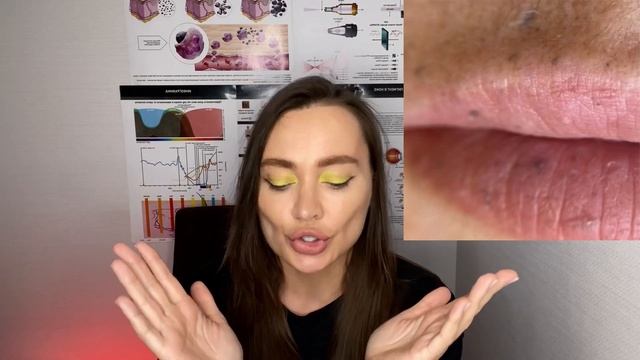 Сажа после аварии в коже клиента | удаление татуажа лица лазером смотреть онлайн