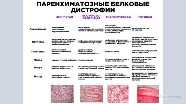 Дистрофии | Классификация, паренхиматозные диспротеинозы и липидозы | Патологическая анатомия смотреть онлайн
