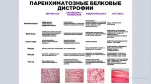 Дистрофии | Классификация, паренхиматозные диспротеинозы и липидозы | Патологическая анатомия