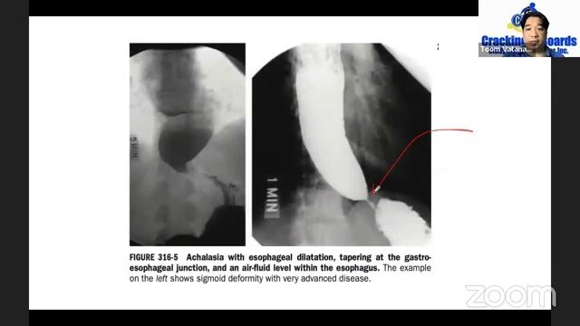 Pathology CRACKED смотреть онлайн