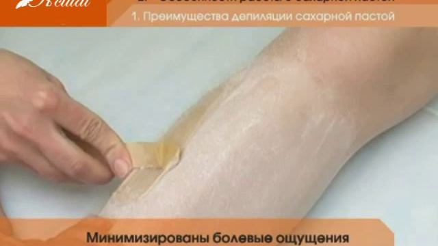 Сахарная эпиляция