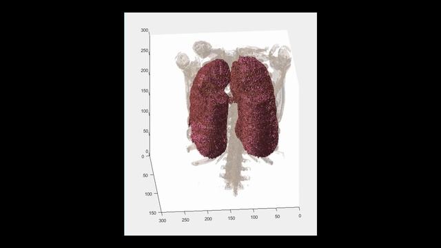 3D Volumetric Image Processing Demo - MATLAB Video смотреть онлайн