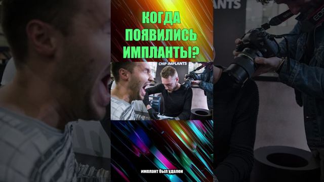 КОГДА ПОЯВИЛИСЬ ИМПЛАНТЫ