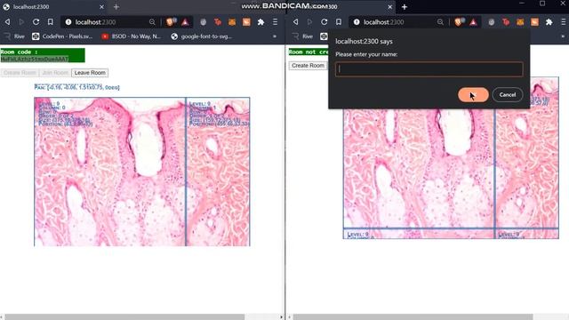 caMicroscope Real-time Slide Editing and Viewing (OpenSeaDragon Pan sync using websockets) смотреть онлайн