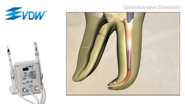 VDW Dental · How To: VDW BeeFill 2in1 - Obturation techniques смотреть онлайн