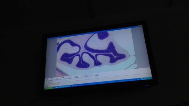 Гистология Разные структуры [Нервная система] смотреть онлайн