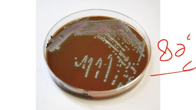 Neisseria meningitidis laboratory diagnosis| Hindi /Urdu animation @thestreamofknowledge смотреть онлайн