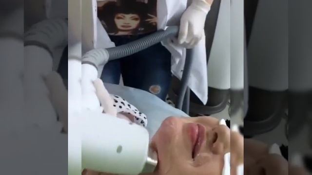 Диодный лазер. Пятигорск 8(962)4277555 смотреть онлайн