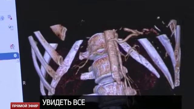 Вместо тысячи слов: в Екатеринбурге появился томограф-универсал смотреть онлайн
