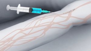 Михал Палыч - Давай кольнёмся