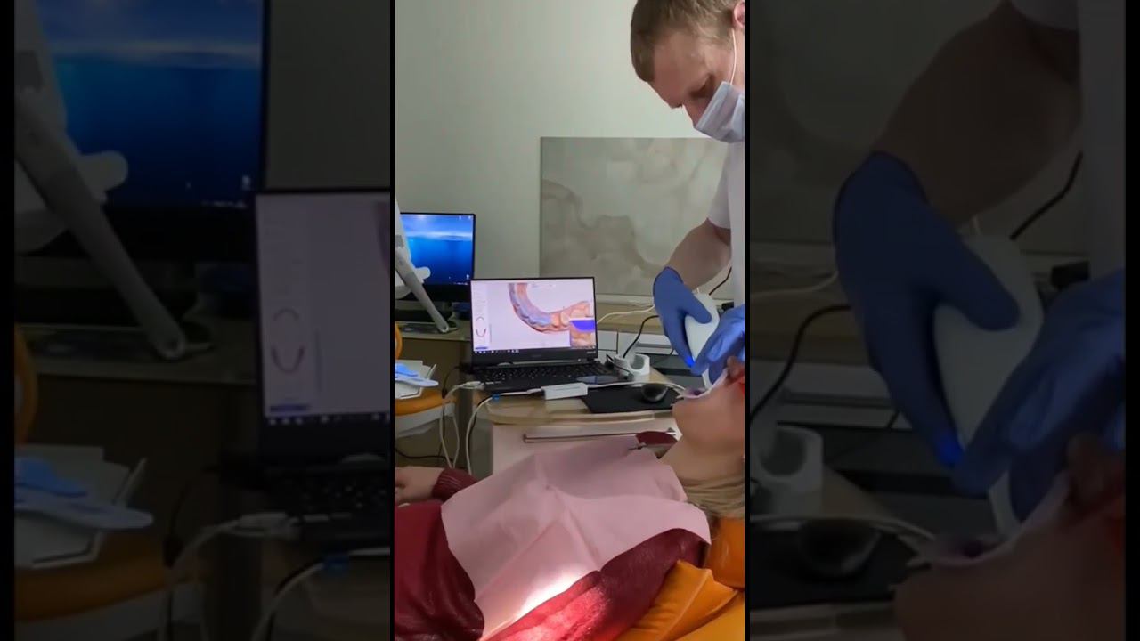 Ортопед Бондаренко Ю. И. выполняет тотальную работу нашей пациентке с помощью сканера Medit i700. смотреть онлайн