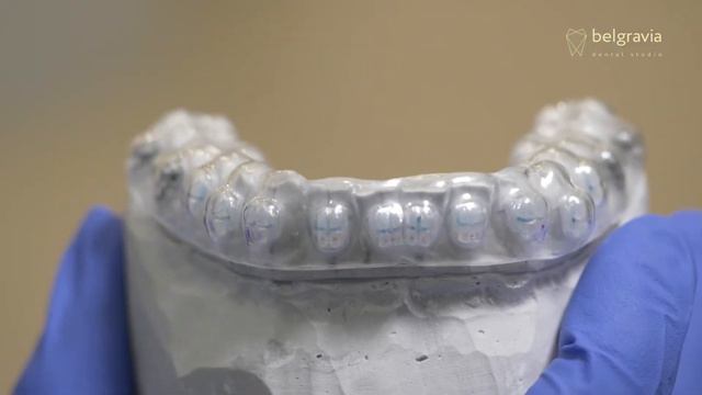 😬 Фиксация брекетов