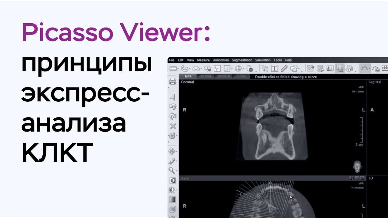 Принципы экспресс-анализа КЛКТ в Picasso Viewer смотреть онлайн