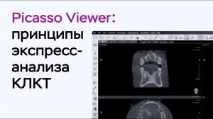 Принципы экспресс-анализа КЛКТ в Picasso Viewer