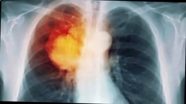 ЖЕСТЬ! ЗАБЫТЫЙ В ТЮРЬМЕ ПОЛУЧИЛ 15 МИЛЛИОНОВ ДОЛЛАРОВ