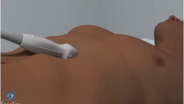 3D-пособие: Получение эхокардиографического изображения из субксифоидального положения смотреть онлайн