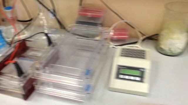 Vlog У нас ветрянка 21.04.2015 смотреть онлайн