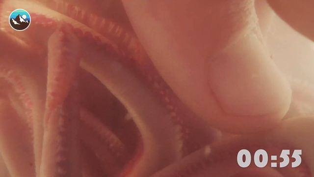 Eaten Alive by Bloodworms! смотреть онлайн