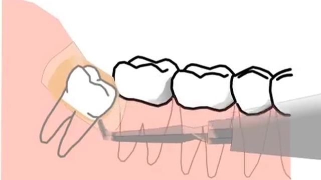 Зуб мудрости в анимационном фильме смотреть онлайн