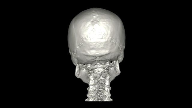 Множественные переломы шейных позвонков смотреть онлайн