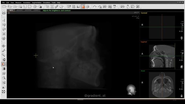 Красота в деталях ремонта