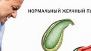 Хронический холецистит   симптомы   причины   профилактика