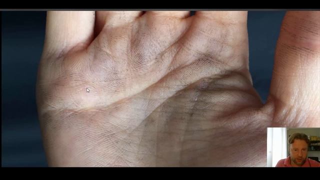 Хиромантия. Остров на Линии Брака. Линия привязанности. смотреть онлайн