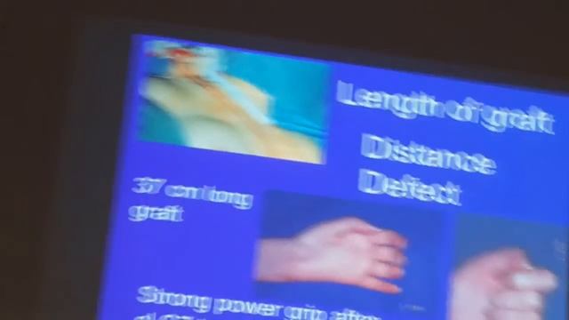 Пластика нервов (prof. Hanno Millesi) ч.2