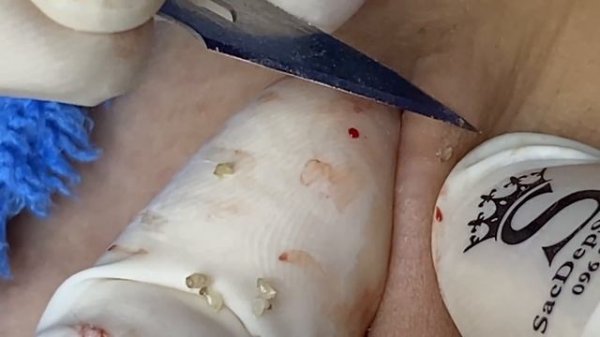 Relax Every Day With Sac Dep Spa #0209