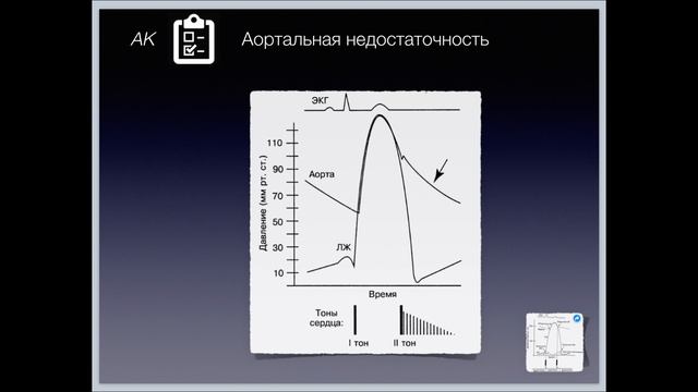 ППС-5-АН смотреть онлайн