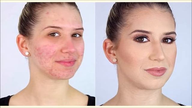 PERMANENT Skin Whitening with Kiwi Face Mask | Get Fair, Clear and Glowing Skin (1 WEEK challenge) смотреть онлайн