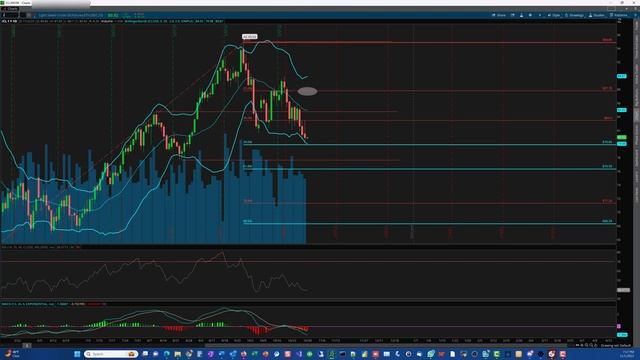 Futures Up!! No Rate Hike ? #stockmarket #daytrading смотреть онлайн
