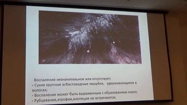 Себорейный дерматит: этиология, патогенез, диагностика и лечение смотреть онлайн