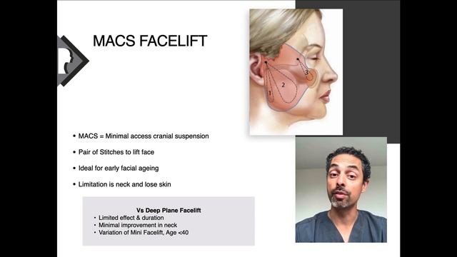 What is a Deep Plane Facelift? смотреть онлайн