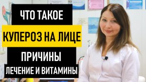 КУПЕРОЗ на ЛИЦЕ: причины и лечение купероза. Чем и как лечить купероз в домашних условиях