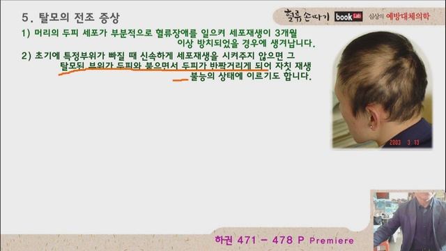 탈모 83강. 비듬과 탈모의 원인과 치료법. Cause and treatment of dandruff hair loss. смотреть онлайн