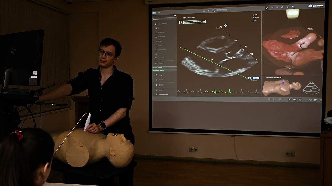 Эхокардиография. Занятие 9: Измерения (на симуляторе) смотреть онлайн