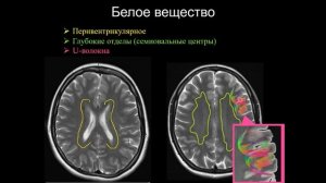 Базовый курс по МРТ  1  Лекция  МР анатомия головного мозга   Лектор  Кротенкова И А