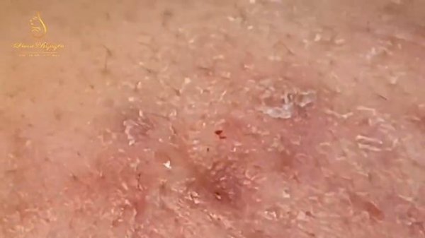 черные точки