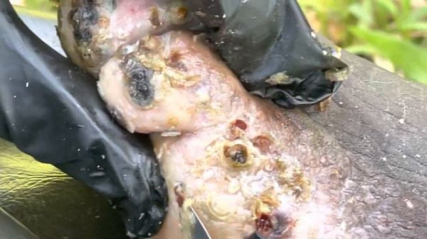 Jigger digging Randon - check full videos @https://riseupsociety.net