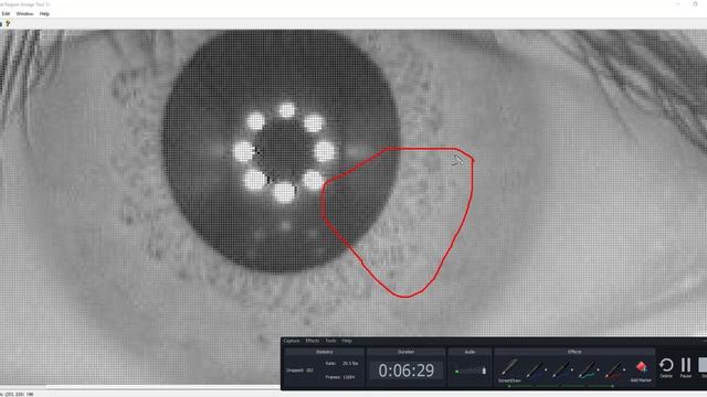 IRIS recognition Using CNN on Casia dataset | +91-9872993883 for query | Total class 224 смотреть онлайн