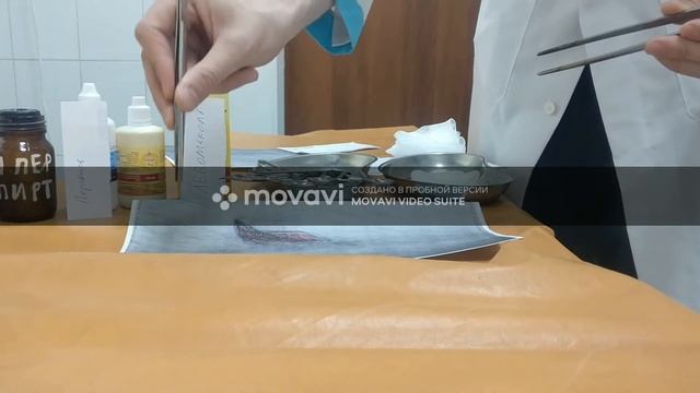 Первичная хирургическая обработка раны смотреть онлайн