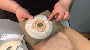 Возможности дополнительной фиксации пластины калоприемника или уроприемника