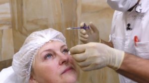 Контурная пластика лица: омоложение с помощью филлеров