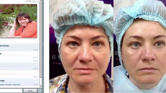 Вебинар для косметологов 16.05.16